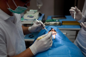 Zubné ošetrenie - Implantácia 